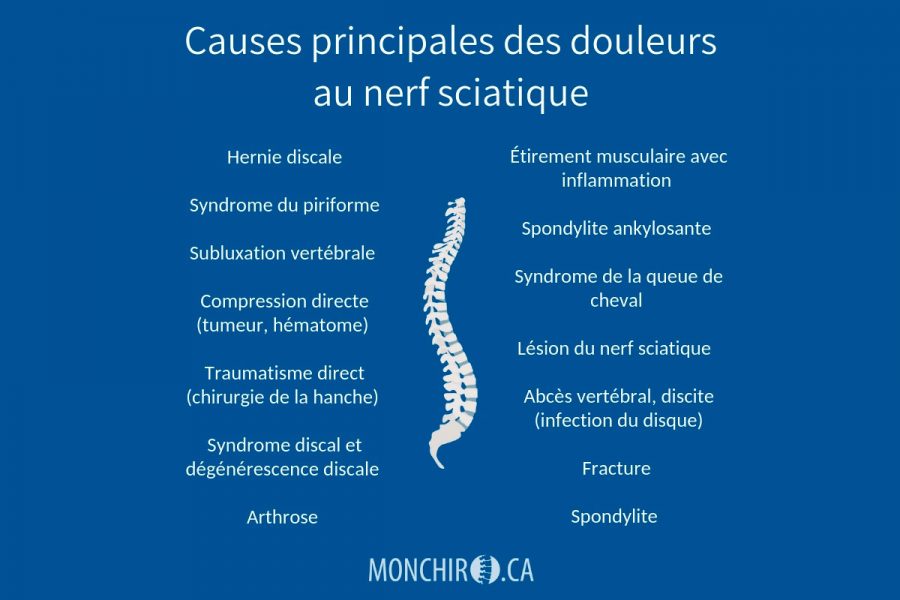 monchiro-nerf-sciatique-causes