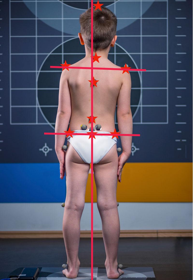 Voici comment évaluer la posture de votre enfant en 3 étapes ...